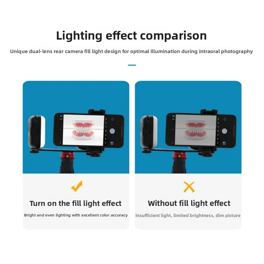 ไฟถ่ายภาพทางทันตกรรม, แฟลช LED - Lighting Gallery บทวิจารณ์และราคา